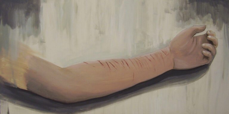 Self injured - Opera di Rossella Bisazza
